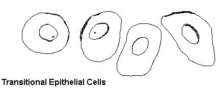 سلول اپیتلیال در ادرار