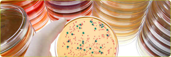 کشت مدفوع - stool culture