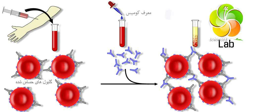 کومبز غیر مستقیم