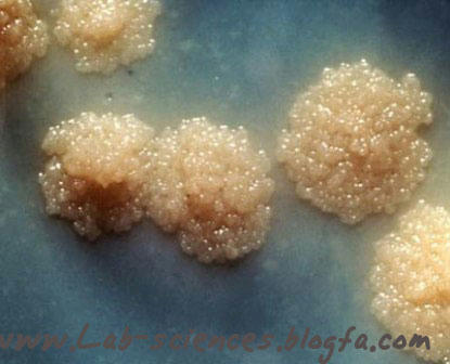 کلنی های باسیل سل بر روی محیط کشت لوین اشتاین جانسون