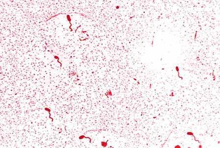 ويبريوكلرا (Vibrio cholera)