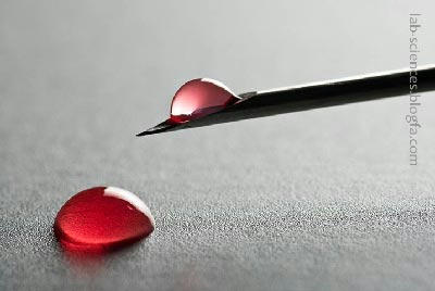 اندازه گیری هموگلوبین 