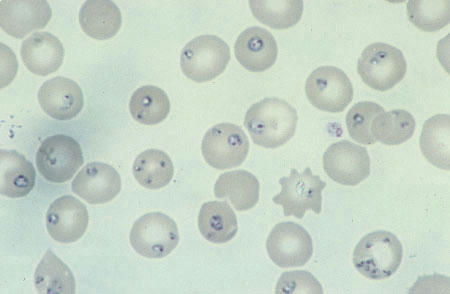 انگل بابزیا در داخل گلبول