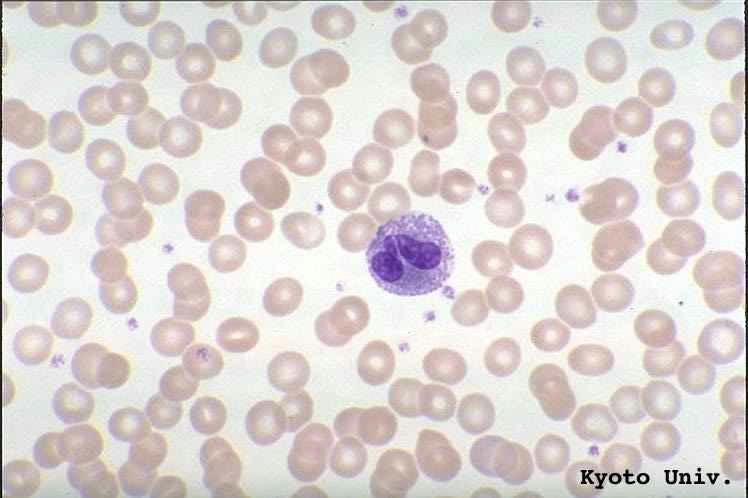 ائوزینوفیلها (یه کم کمرنگتر است ) در May-Giemsa stain, x1000