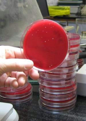 كشت ادرار در ازمايشگاه باكتري شناسي 