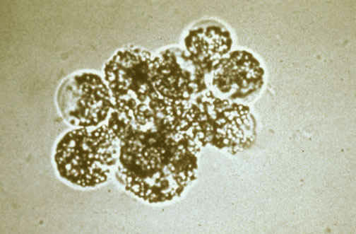 ذرات چربی در ادرار