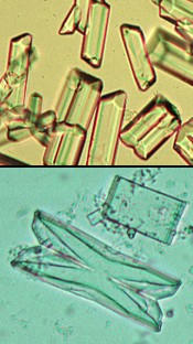 تریپیل فسفات 