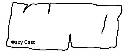 کست واکسی در ادرار