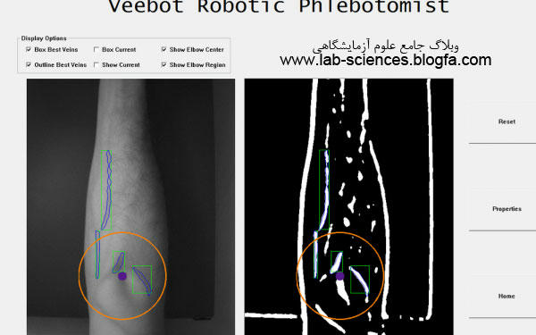 ربات خونگیر