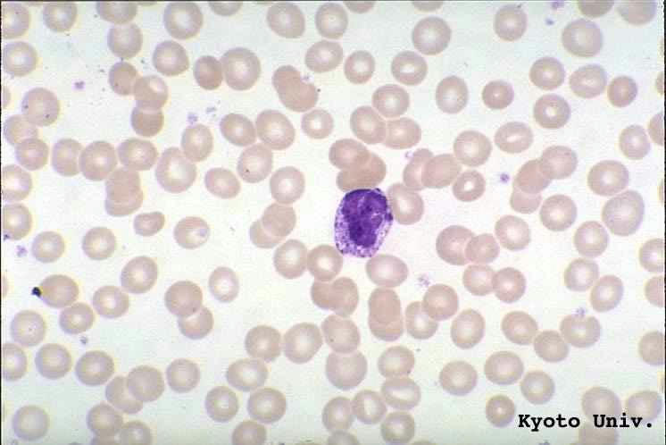 بازوفیل با گرانولهای درشت معلوم در May-Giemsa stain, x1000