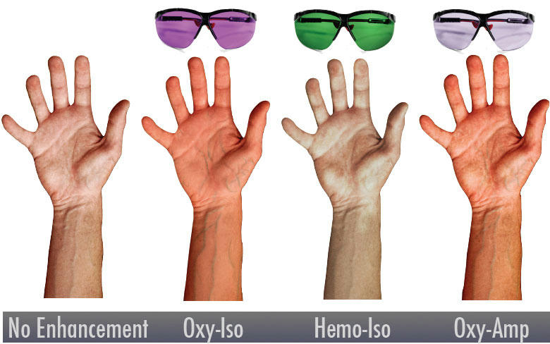 عینک رگ یاب 