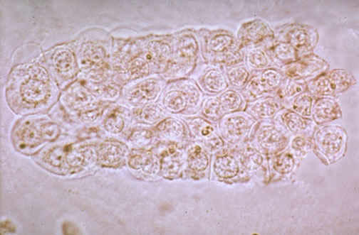 کست سلولهای توبولار