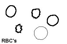 گلبول قرمز در ادرار