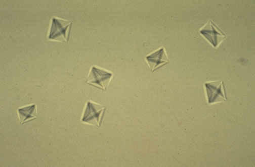 کریستال اگزالات کلسیم 