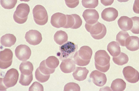 تروفازوئید پلاسمدیوم ویواکس در داخل گلبول