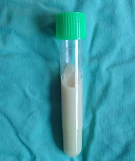 مايع پلور (جنب) (Pleural fluid)