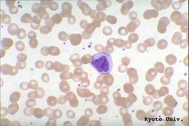 مونوسیت با هسته دنجتر در May-Giemsa stain, x1000