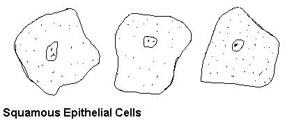 سلول های اپیتلیال در ادرار