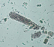 کست گرانول دار 