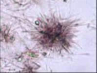 کریستال تیروزین 