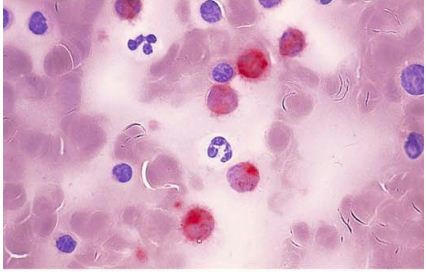رنگ امیزی trap در مغز استخوان - bone marrow
