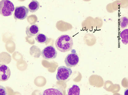 سلول باند نوتروفیل