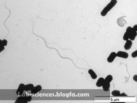 رنگ امیزی فلاژله یا تاژک