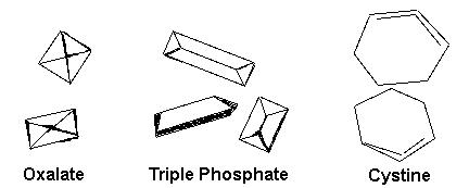 انواع کریستال در ادرار