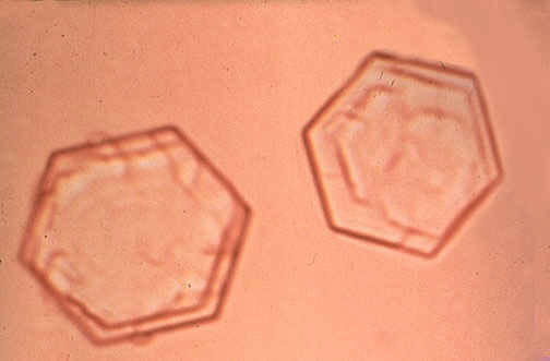 کریستال سیتئین