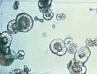 کریستال لوسین 