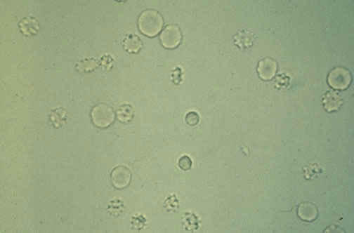 گبلول قرمز در ادرار