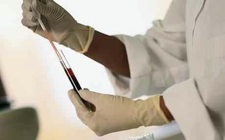 ازمایش خون blood test