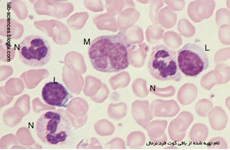 Granulocyte and Monocyte Morphology | ریخت شناسی گرانولسیت و مونوسیت 