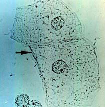 سلول اپیتلیال