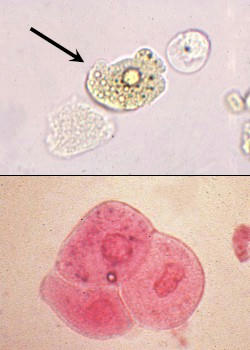 پارا بازالی