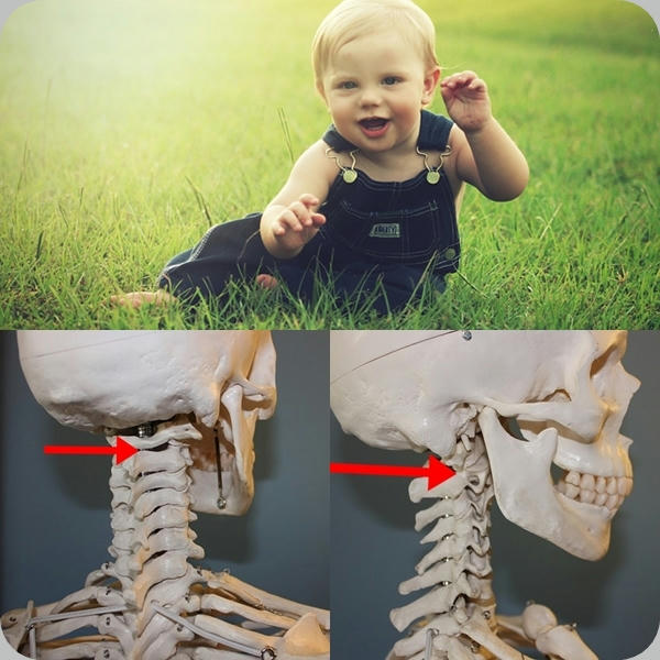 Milagro de la ciencia: Reimplantan cabeza a un bebe decapitado en Australia