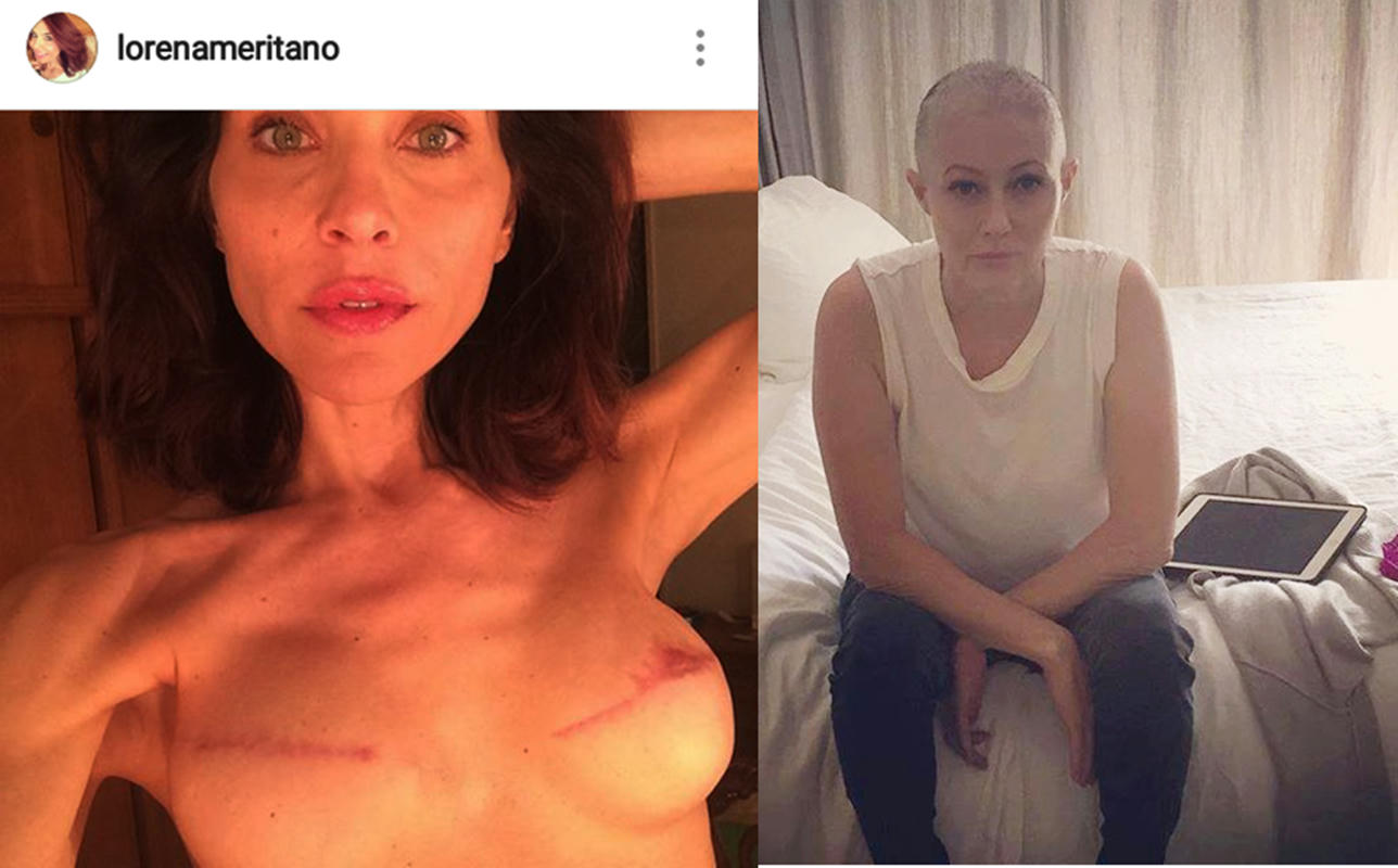 Lorena Meritano y Shannen Doherty, muestran el drama del cáncer en fotos
