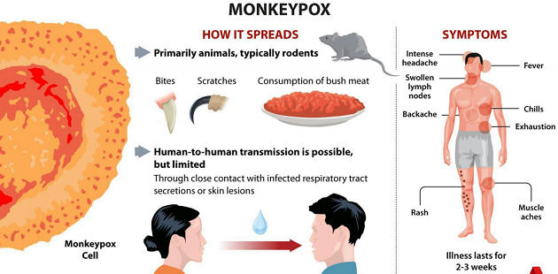Monkeypox Virus | Burning Issues | PDF Download StudyIQ