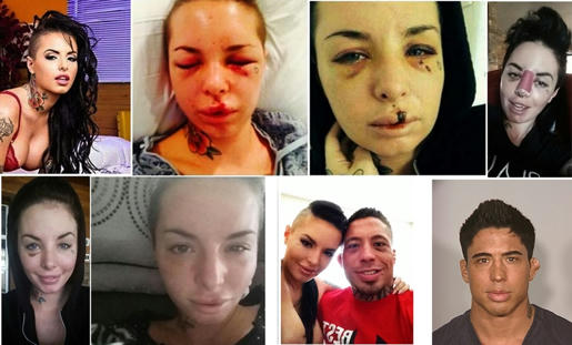  El rostro de la actriz porno norteamericana Christy Mack, se convirtió en un símbolo más de la agresión sufrida por las mujeres